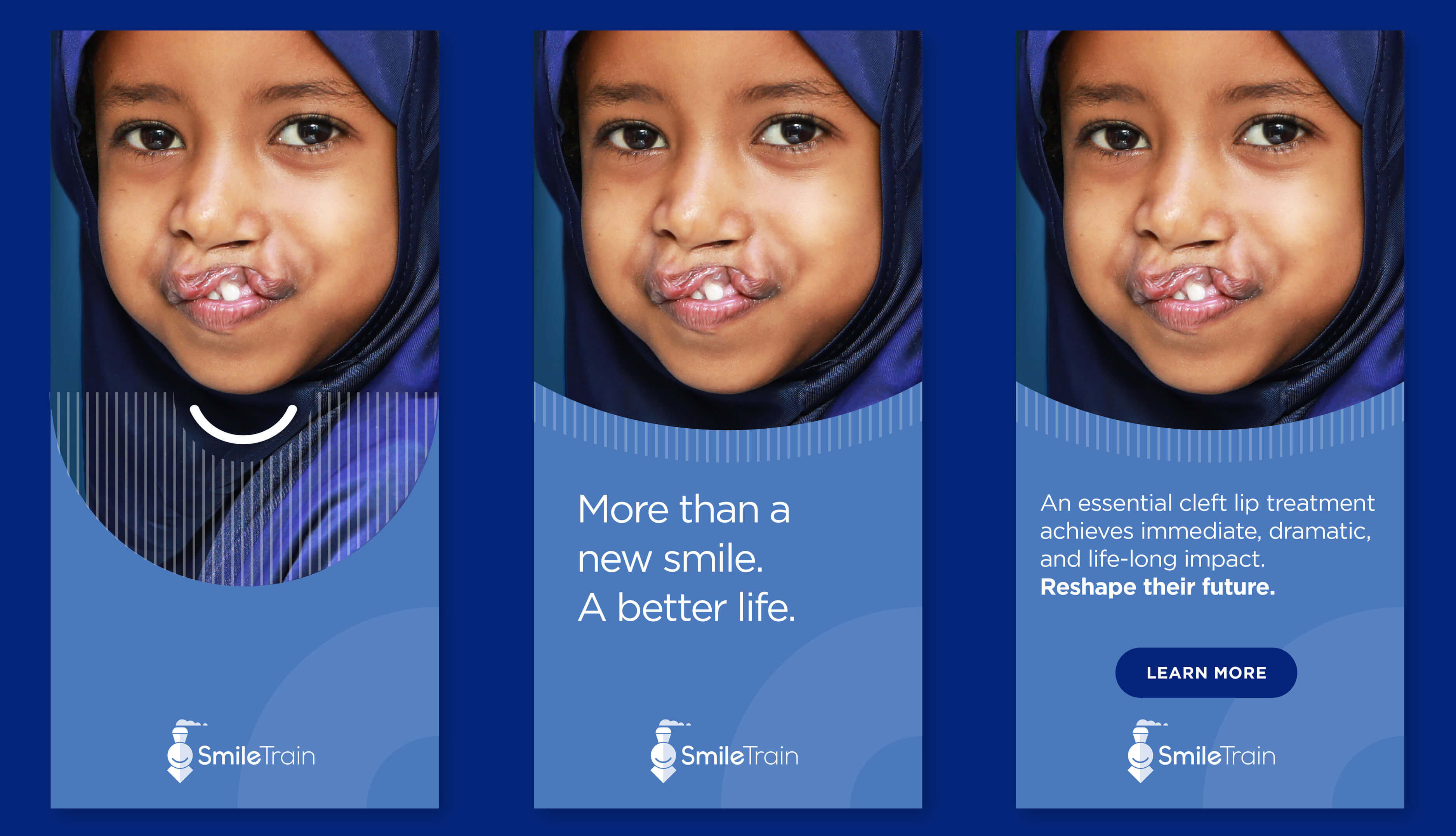 SmileTrain Ads