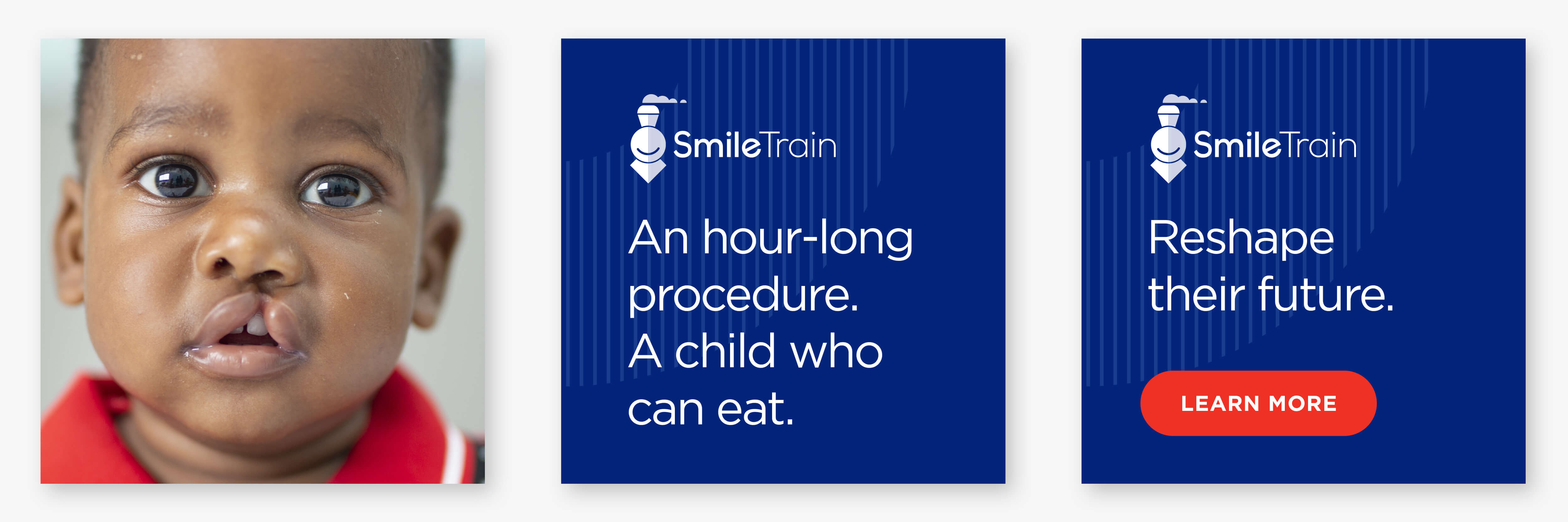 SmileTrain Ads